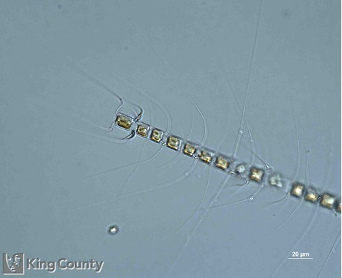 Photo of Chaetoceros crucifer